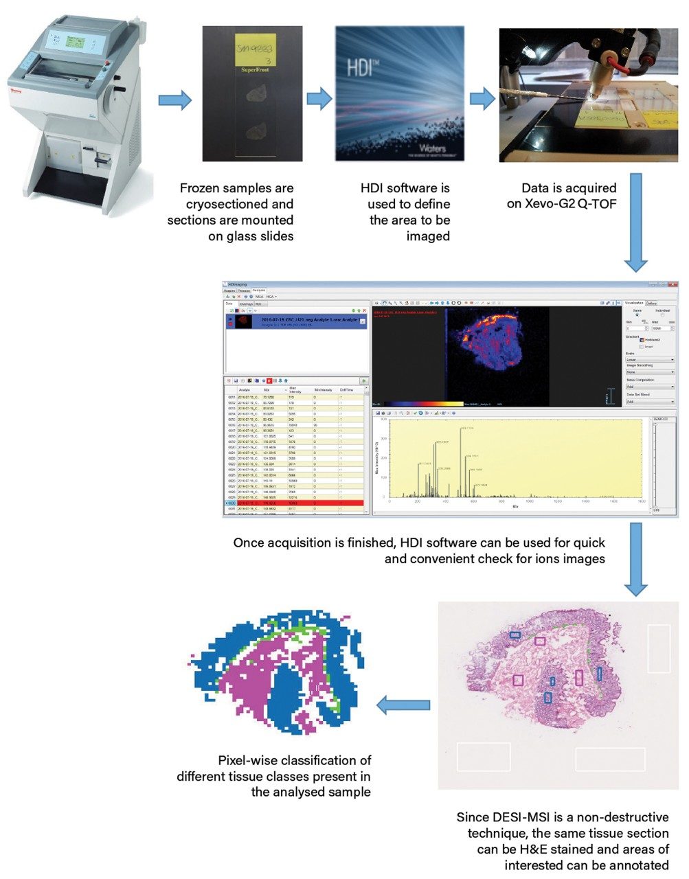 Workflow of DESI-MSI of colorectal sample