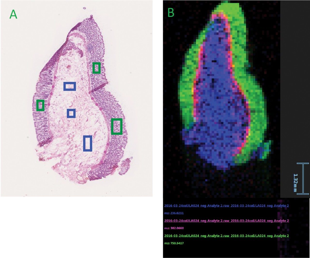 Healthy colorectal tissue sample analyzed in negative ion mode at 4 scans/second