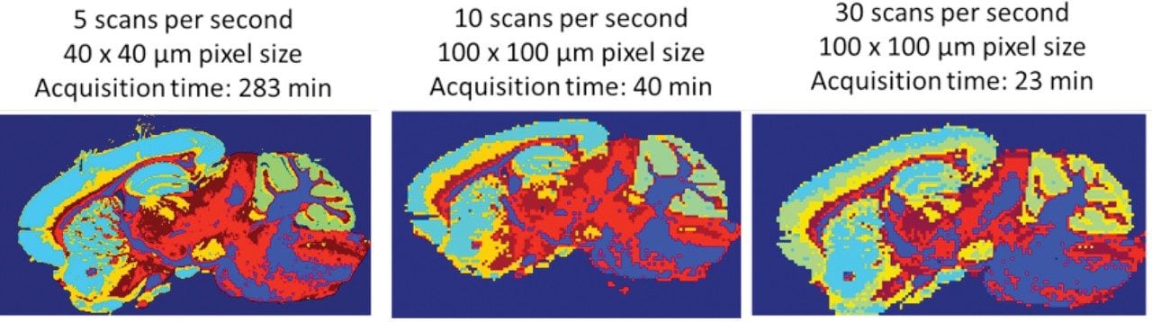 K-means clustering of MS images of mouse brain