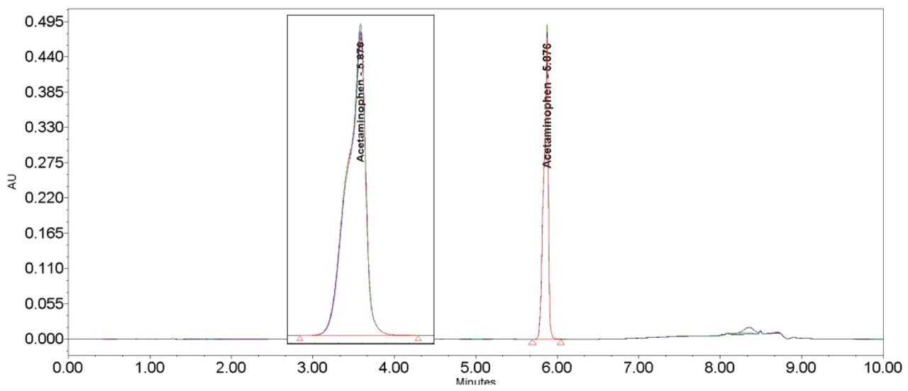 Acetaminophen USP method without additional pre-injection volume. Acetaminophen overlay (n=6) chromatogram and result table without loop fitted.