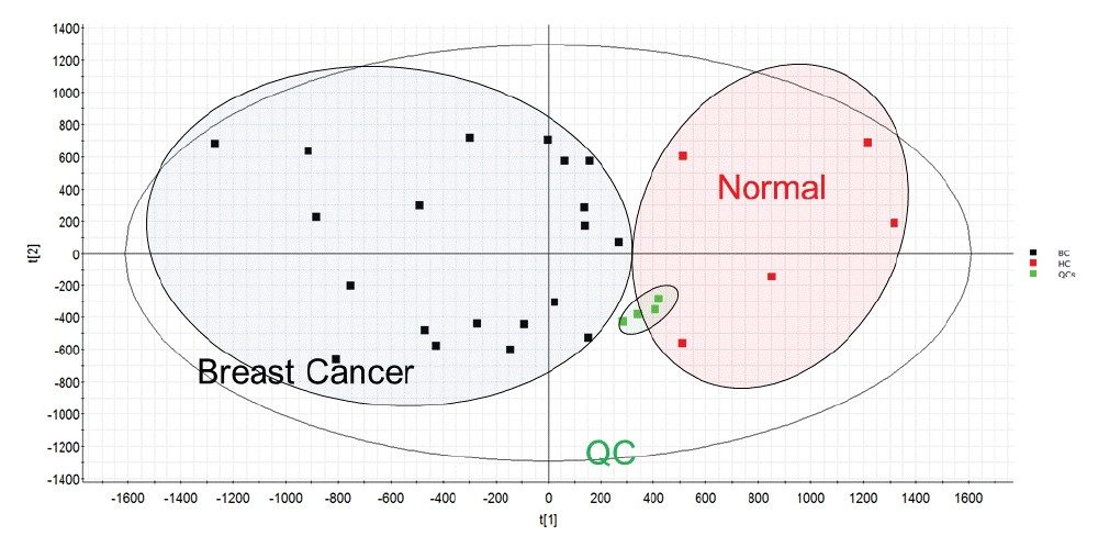  Multivariate statistical analysis representing the lipidomic data