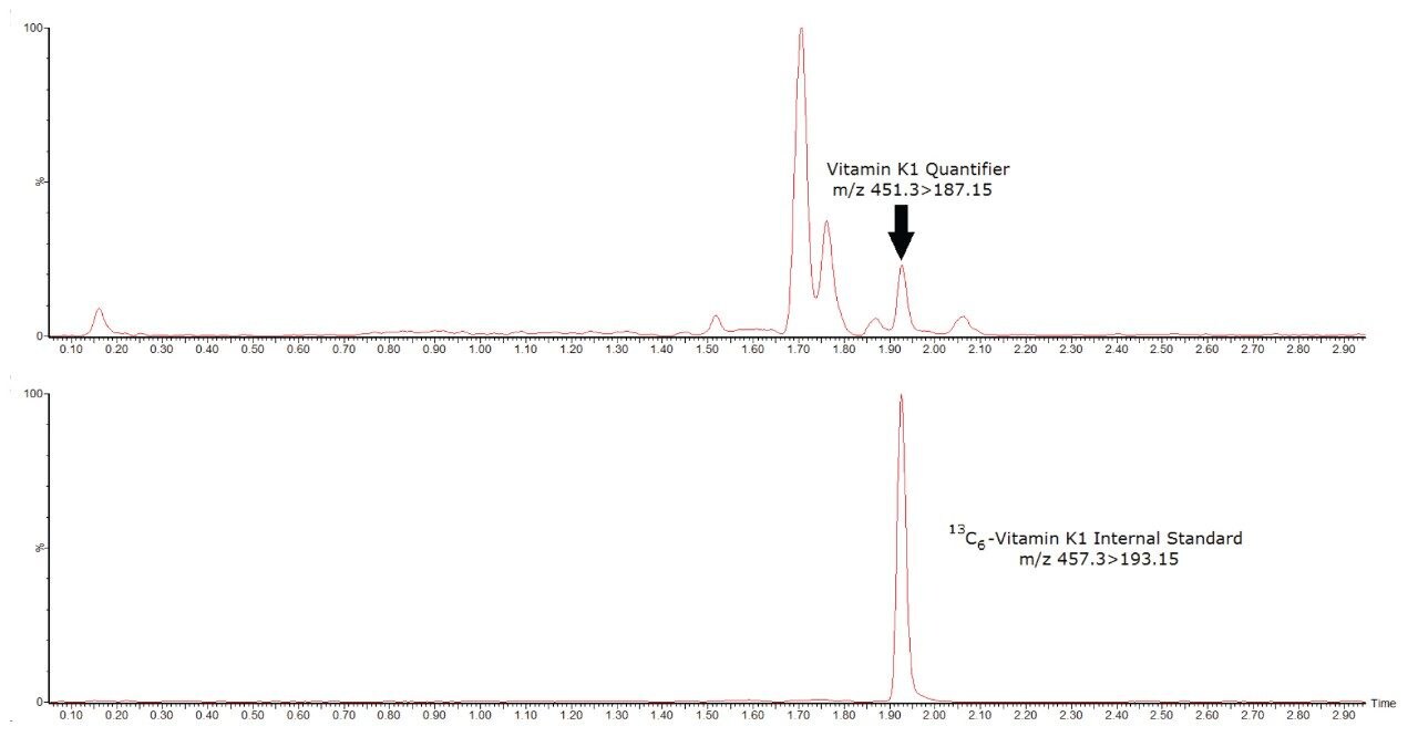 Chromatogram