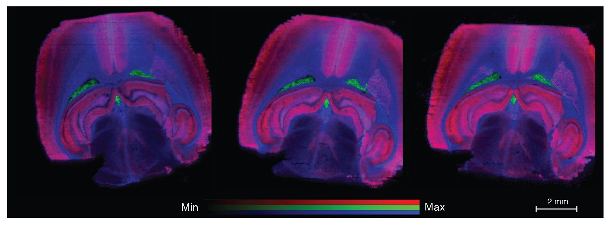 Example images, overlay of lipids putatively identified as PS(40:6) red, PS(38:4) green, and PE(p38:4) blue. Five scans per second (left), 10 scans per second (middle), and 20 scans per second (right)