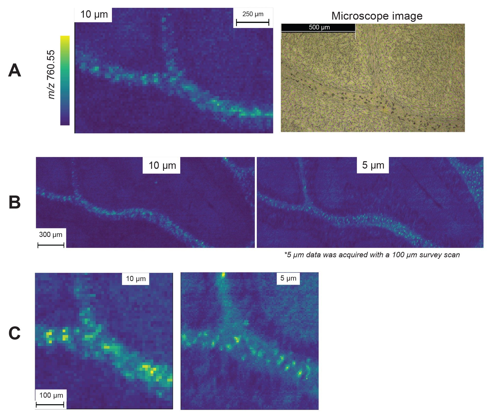 A small area of a murine cerebellum fissure with coresponding microscope image