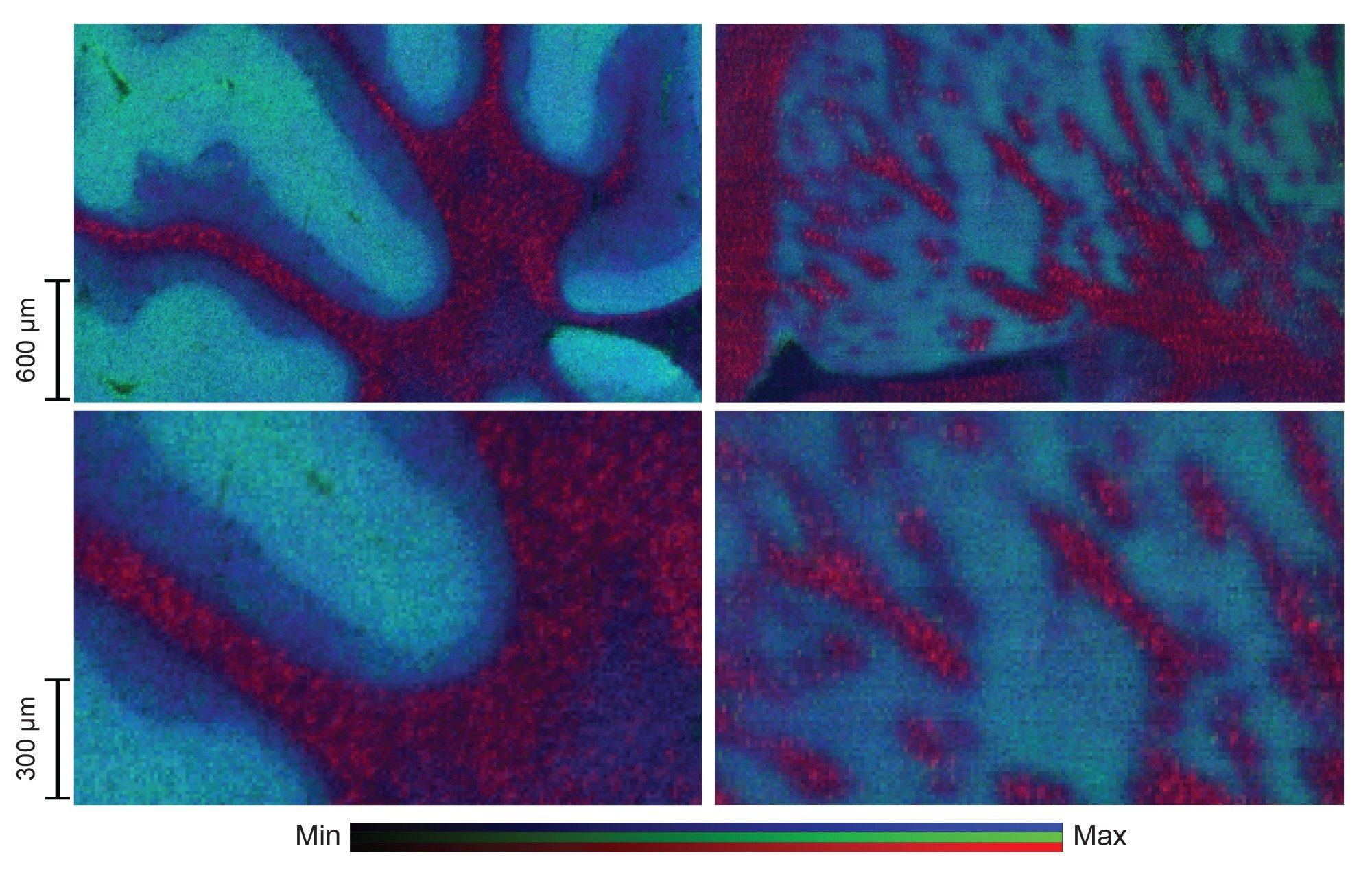 Enlarged view of the cerebellum (left) and the striatum (right) taken from the murine brain image displayed in Figure 1