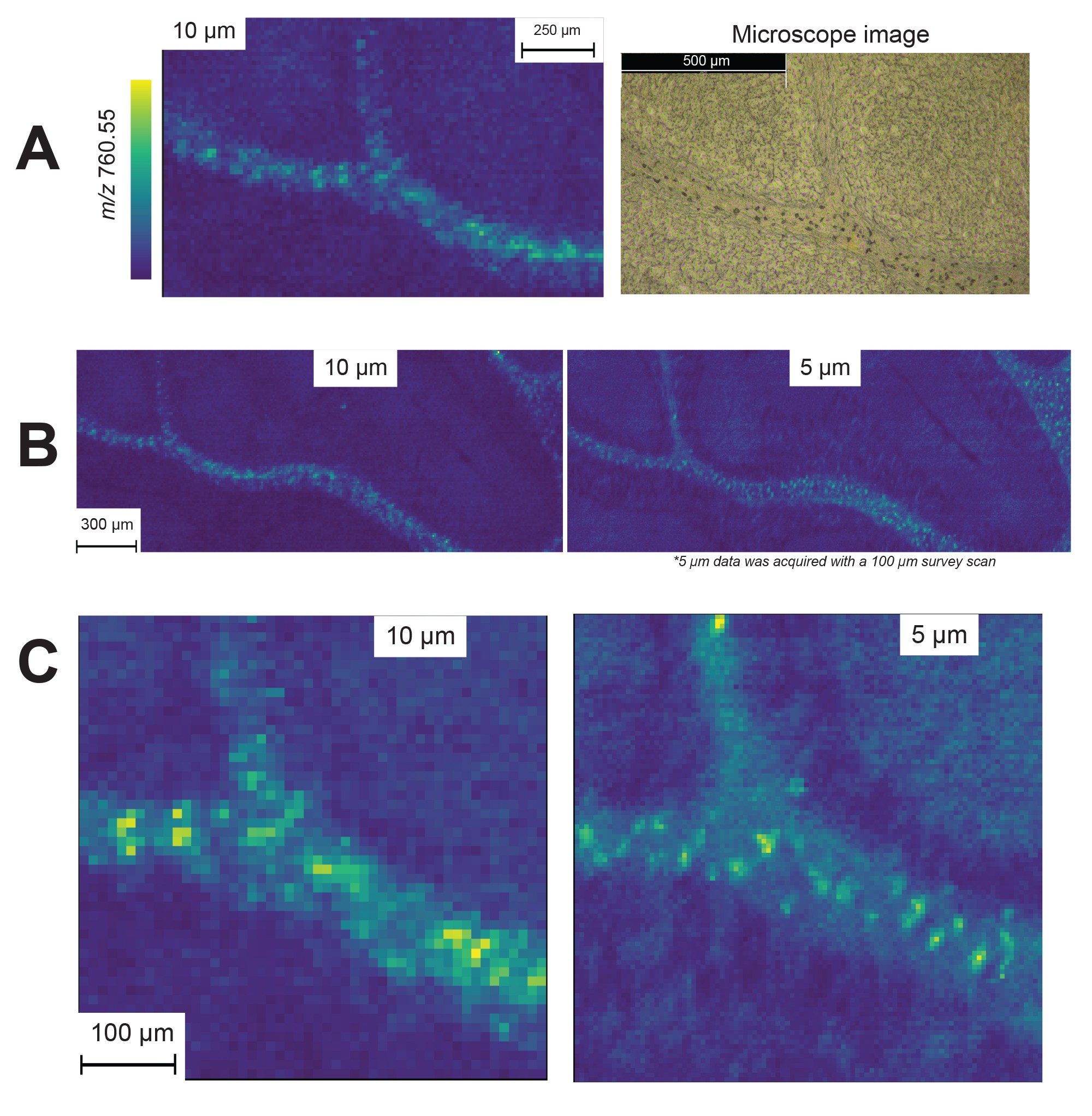 A small area of a murine cerebellum fissure with coresponding microscope image