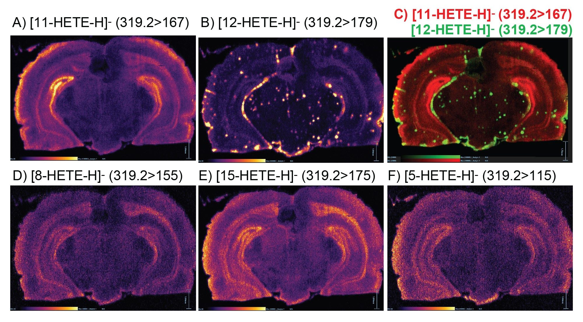 Negative ionization mode mouse brain MRM ions images acquired at 25 x 25 µm pixel size of five hydroxyeicosatetraenoic acid (HETE) isomeric compounds with different double bond position