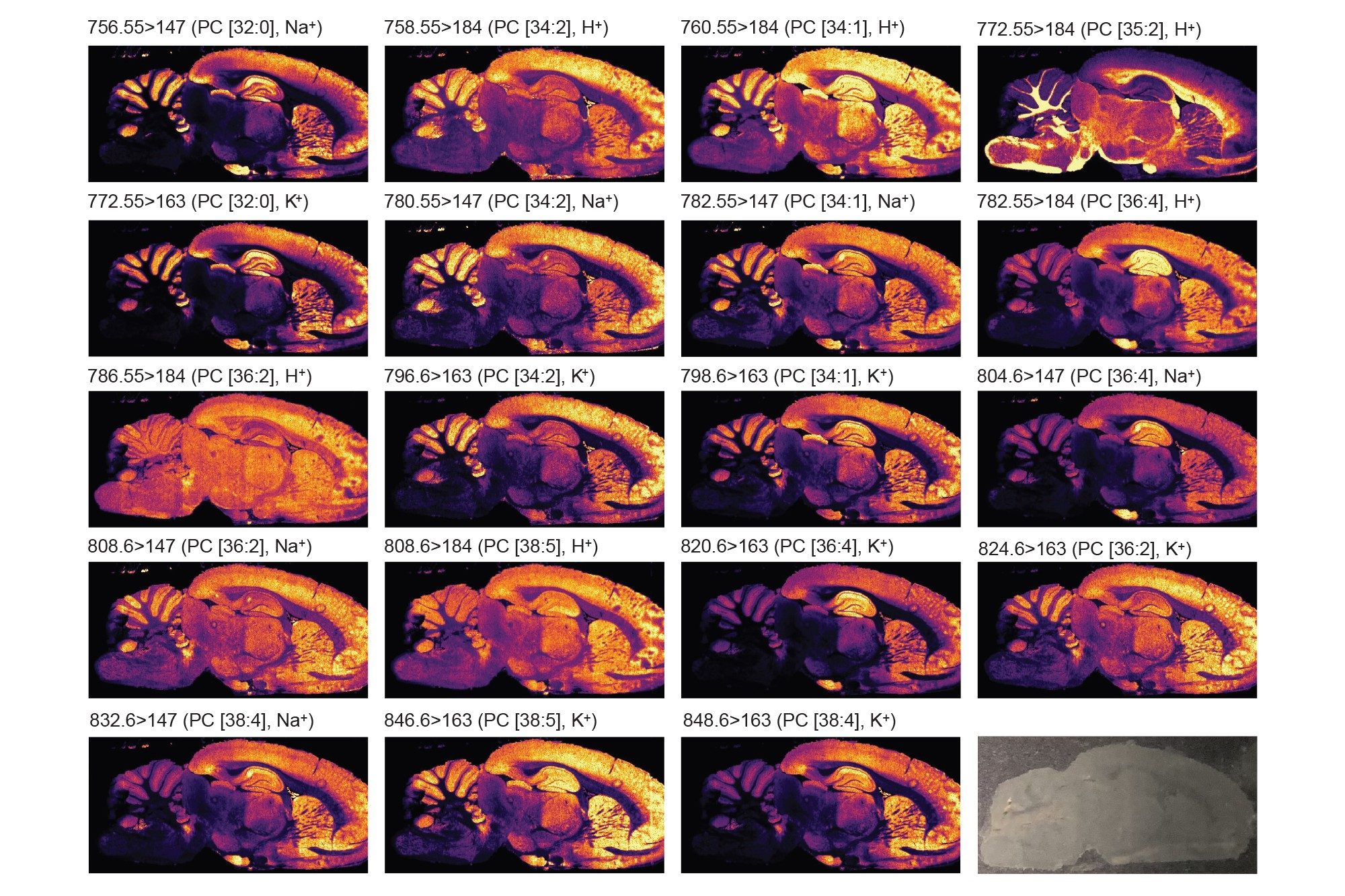 MRM ions images of rodent brain putatively identified phospholipids acquired in positive ionization mode at 35 x 35 µm pixel size