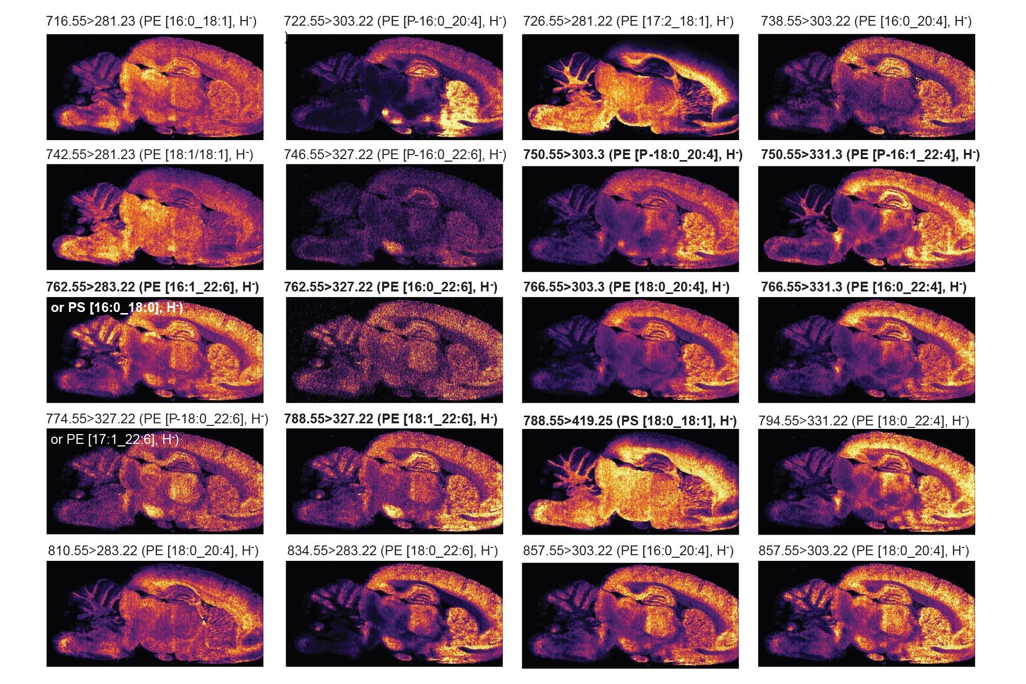 MRM ions images of rodent brain putatively identified phospholipids acquired in negative ionization mode at 35 µm pixel size