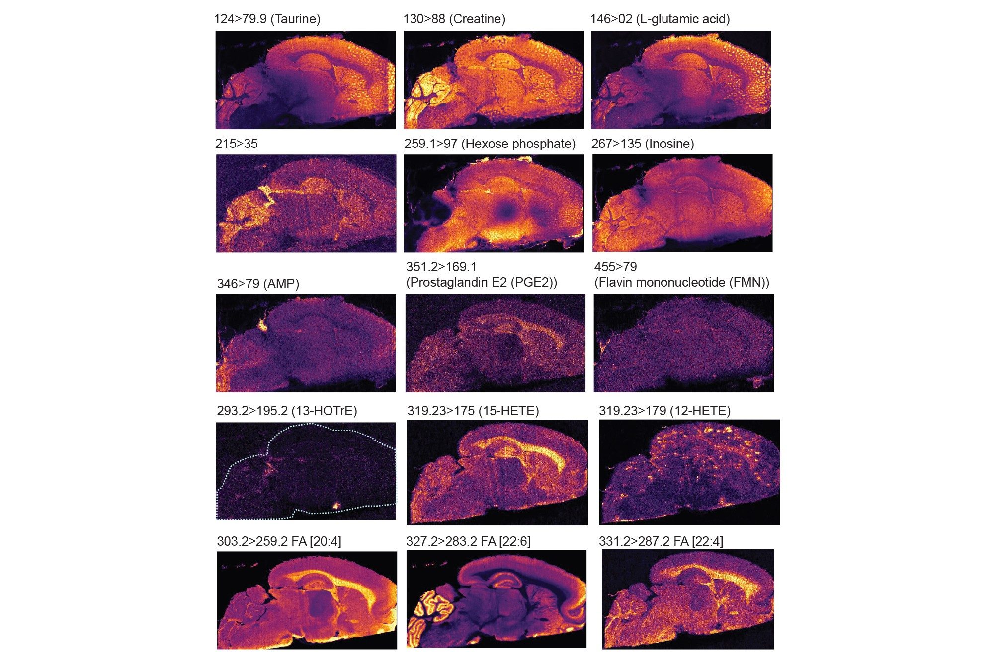 MRM ions images of rodent brain putatively identified small endogenous molecules such as amino acids, TCA cycle metabolites
