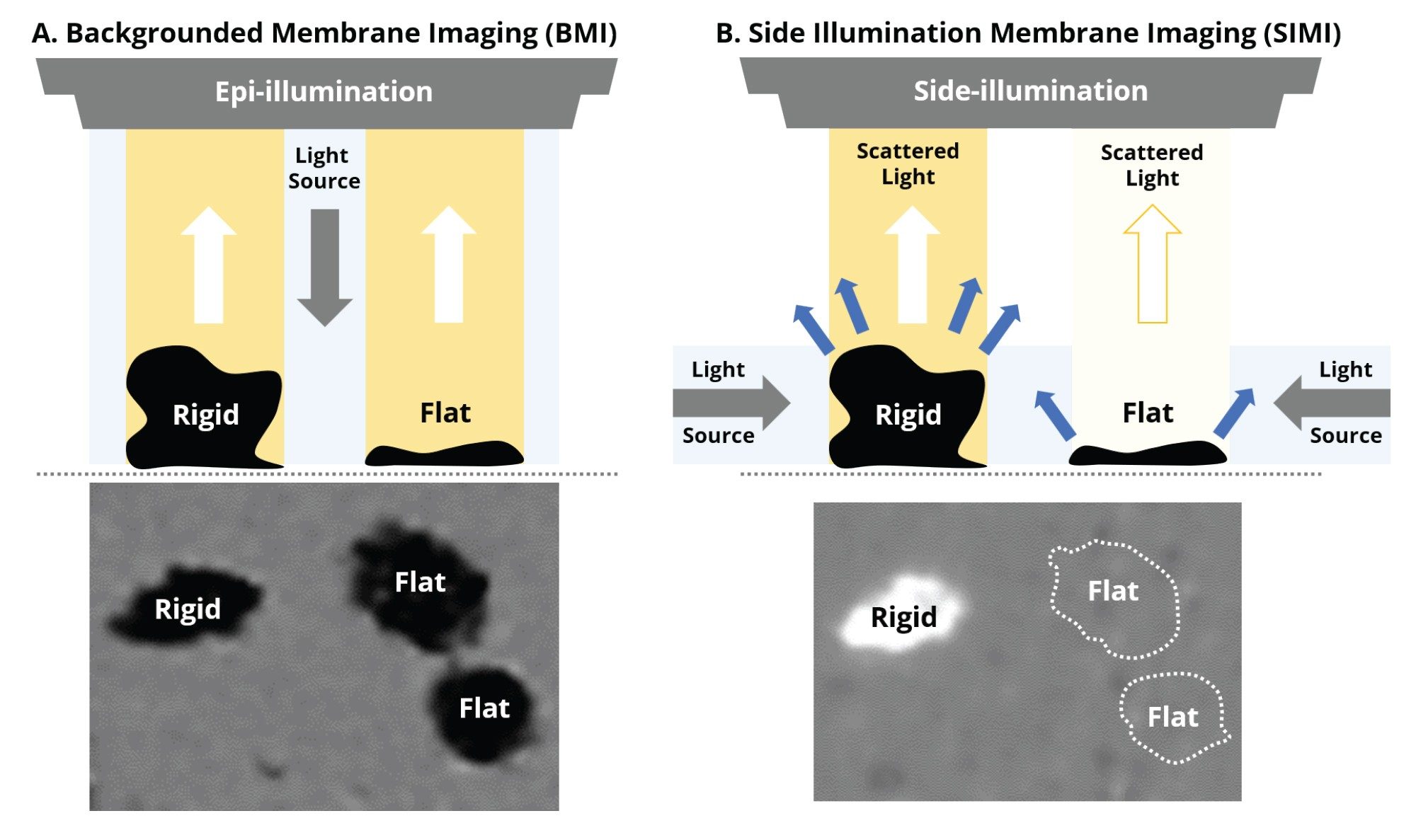 Schematic of the impact of light scattering on rigid and flat (soft) particles via (a) backgrounded membrane imaging (BMI) demonstrating isotropic scattering and (b) side illumination membrane imaging (SIMI) with enhanced side scattering