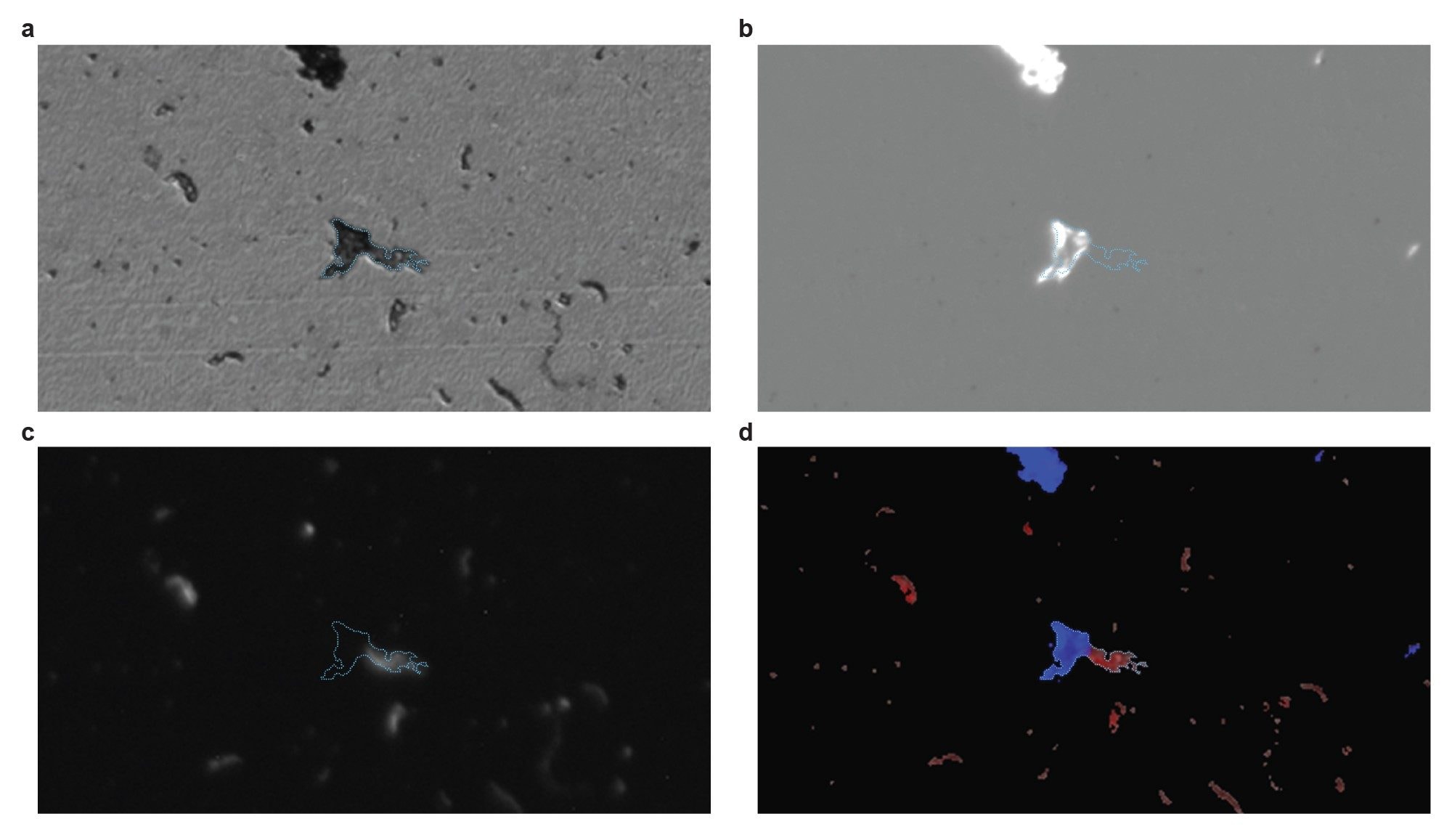 A mixed ETFE and hIgG particle imaged via