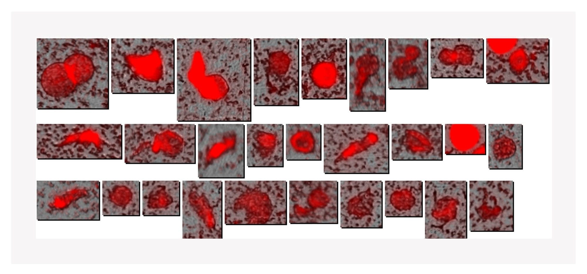 Particle Vue software image gallery enables analysis at the singleparticle