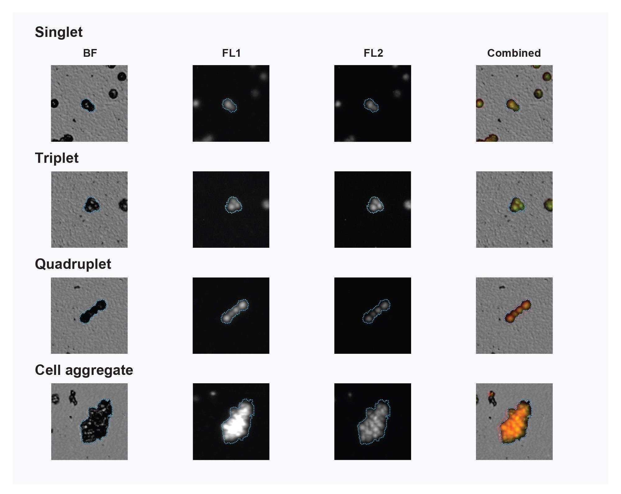 Combined brightfield and fluorescence images from the Aura CL System of cells labeled with a DNA stain (FL2) and ThT for protein (FL1)