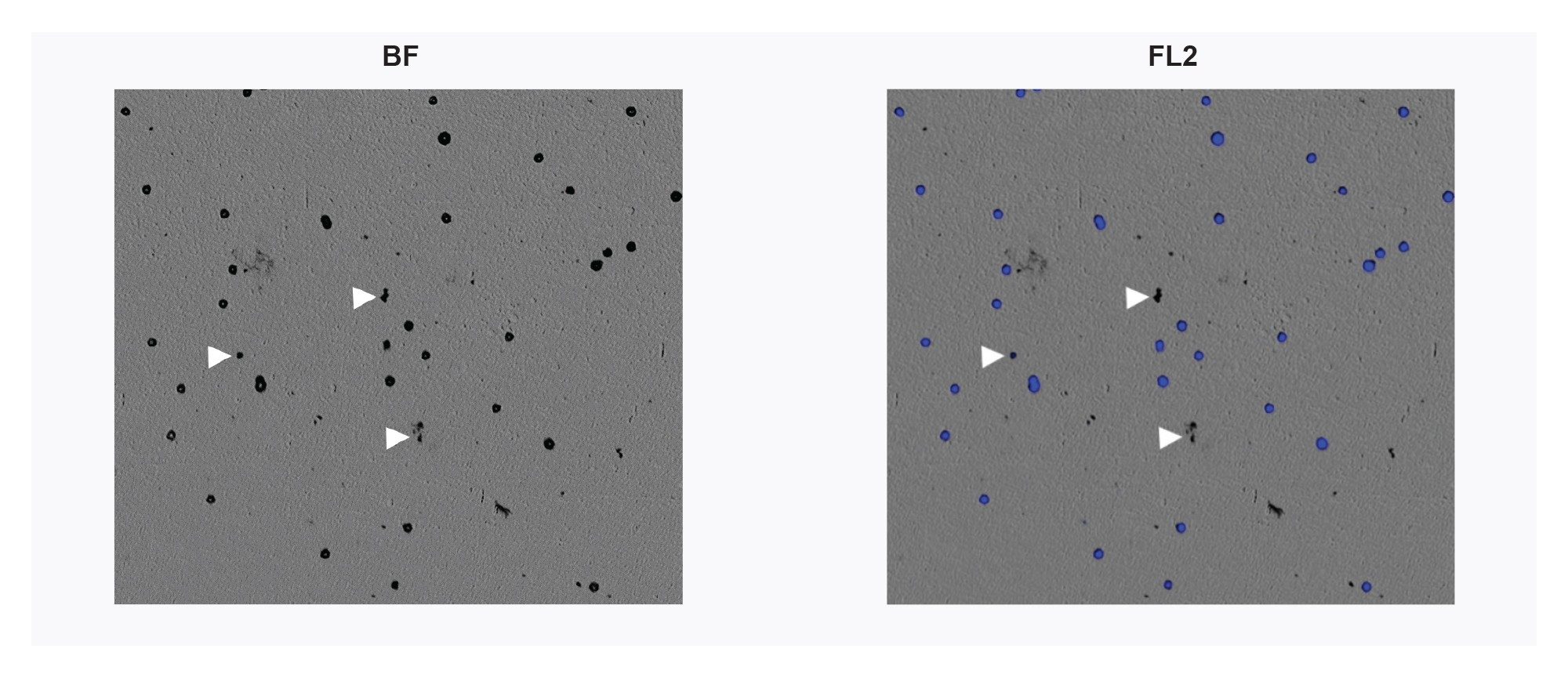 CAR-T cells as imaged by BMI and FMM. Cells can be positively identified using the DNA stain DAPI (blue), highlighting additional noncellular particles within the sample (arrows)