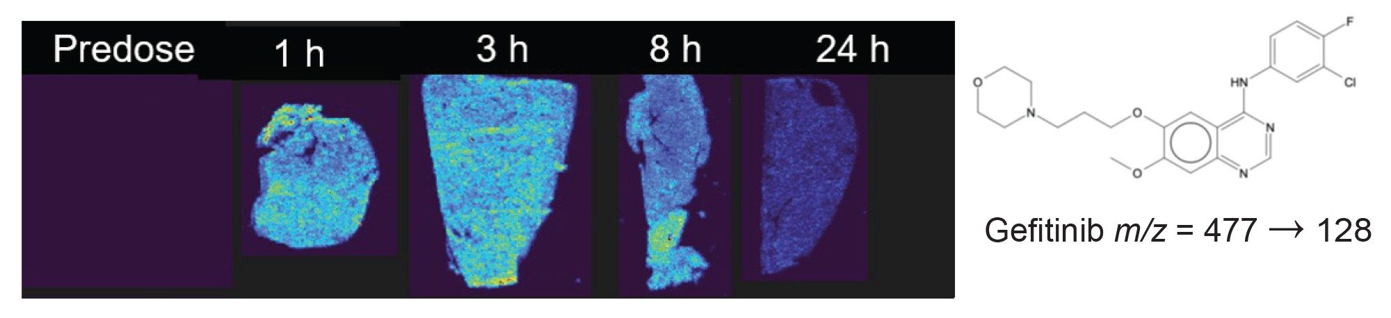 Visualization of gefitinib in liver tissue slices using DESI-MS Imaging operated in mode using the transition