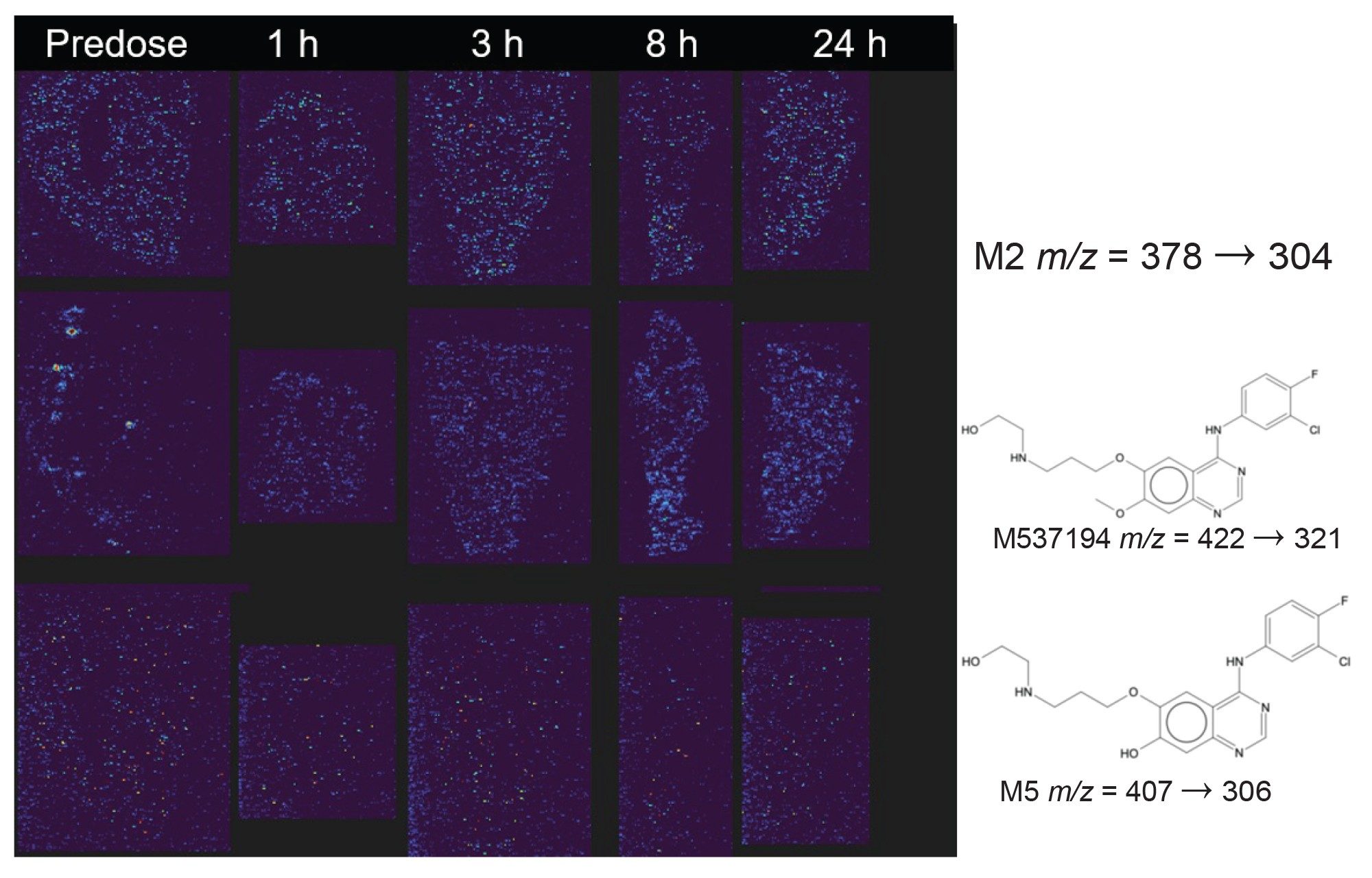 Visualization of metabolites M2 (m/z = 378  304.1), M537194 (m/z = 422  321.0), M5 (m/z = 407.13 306.04) in liver tissue slices using DESI-MS Imaging