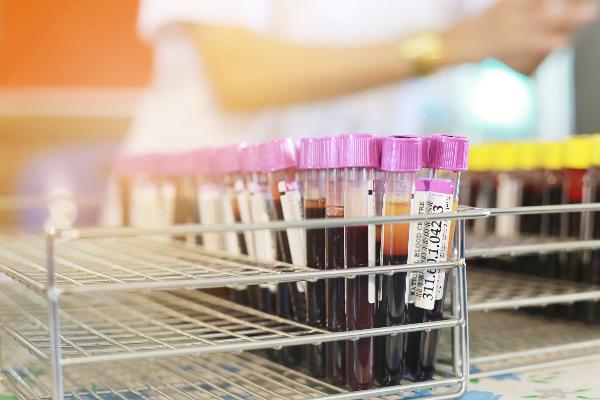 Provette per campioni di sangue da una donazione di sangue per l’analisi