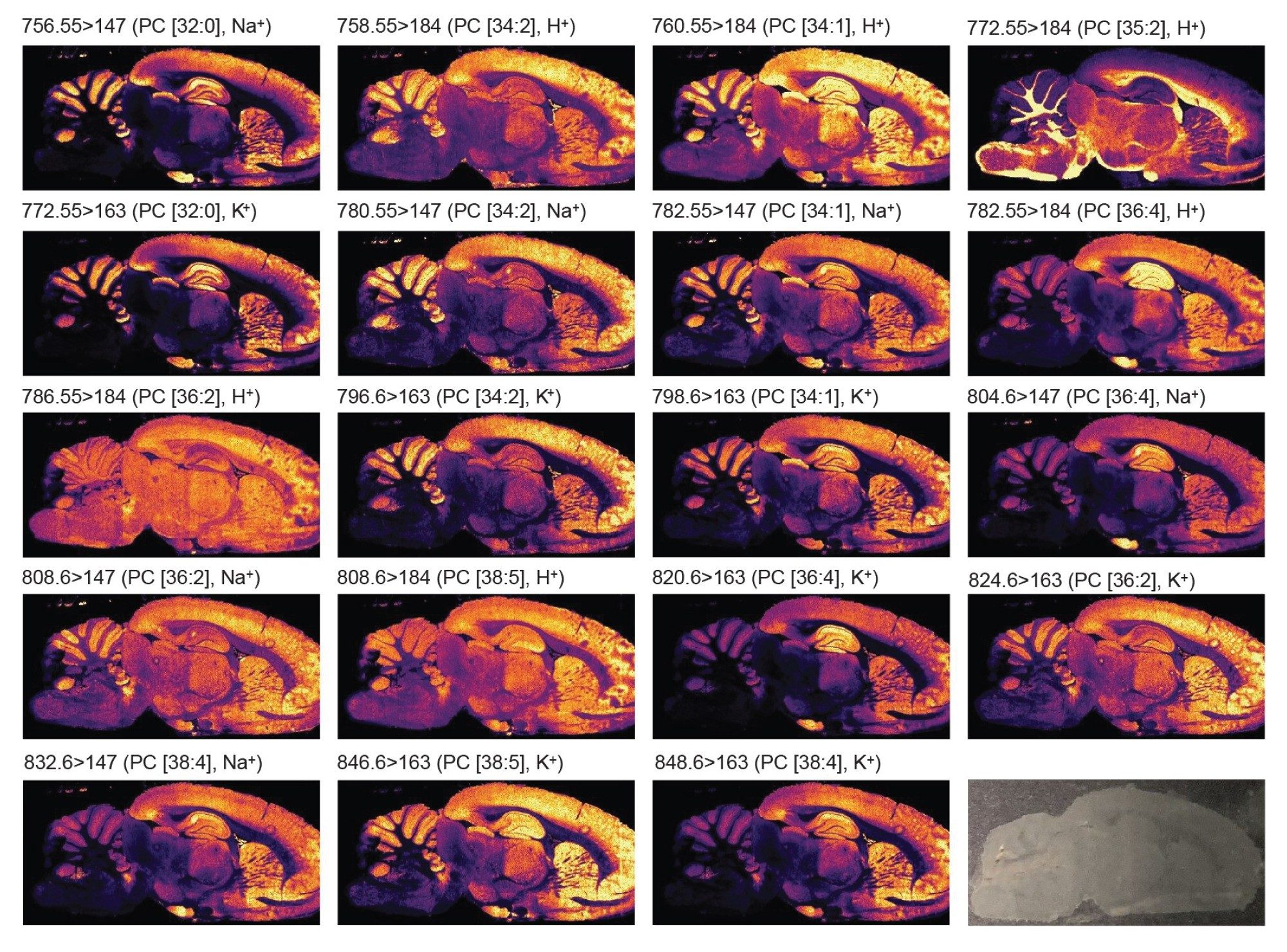 ポジティブイオンモードにて、ピクセルサイズ 35 × 35 µm で取得したラット脳組織中のターゲットリン脂質の MRM イオンイメージ