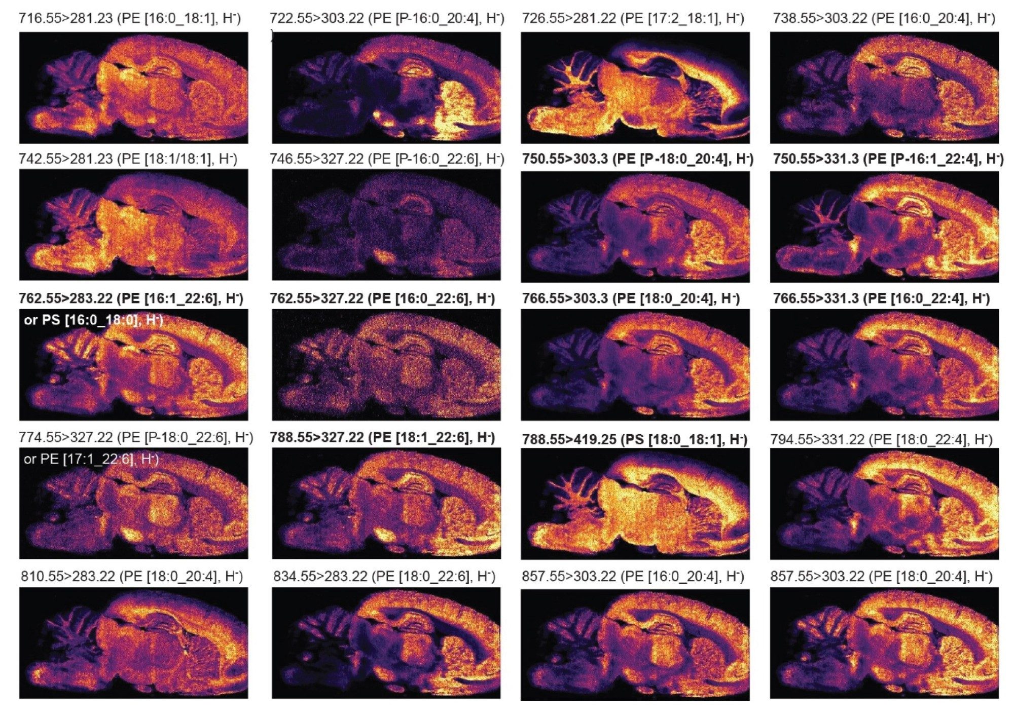 ネガティブイオンモードにて、ピクセルサイズ 35 µm で取得したラット脳組織中のターゲットリン脂質の MRM イオンイメージ