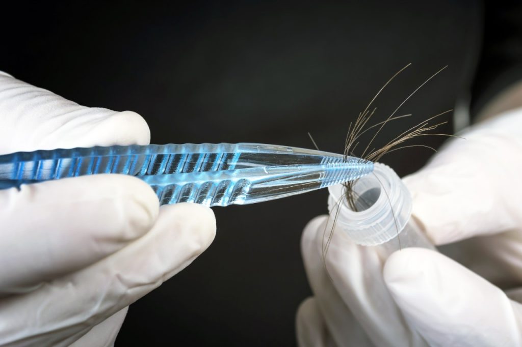 Screening For Anabolic Steroids And Their Esters Using Hair Analyzed By Gc Tandem Quadrupole Ms Waters